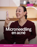 Preventa - Microneedling en acné